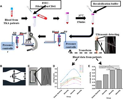 Effect of intermittent pneumatic compression on preventing deep vein thrombosis using microfluidic vein chip